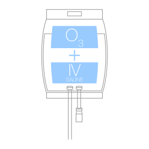 Medical Ozone IV Saline Infusions
