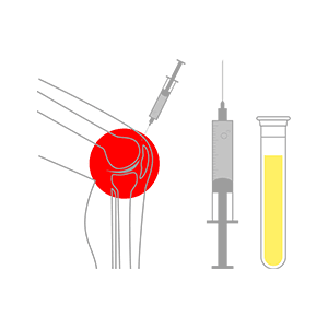 Advanced Clinical m.Prolozone and PRP
